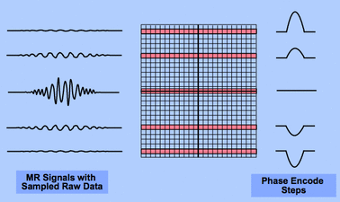 spin-warp imaging (cartesian)