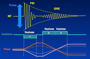 Gradient Echo (GRE)