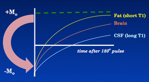 Inversion Recovery (IR) Sequence