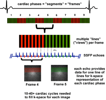 segmented cardiac MRI