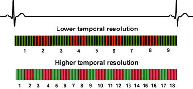 temporal resolution cardiac MRI