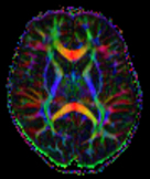 Diffusion MR images