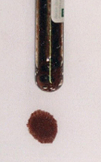 methemoglobin test tube