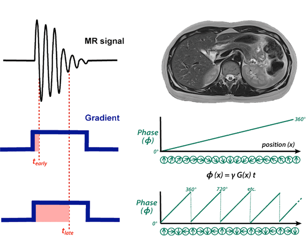 imaging gradients and phase