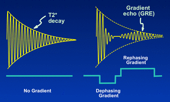 Gradient echo (GRE)