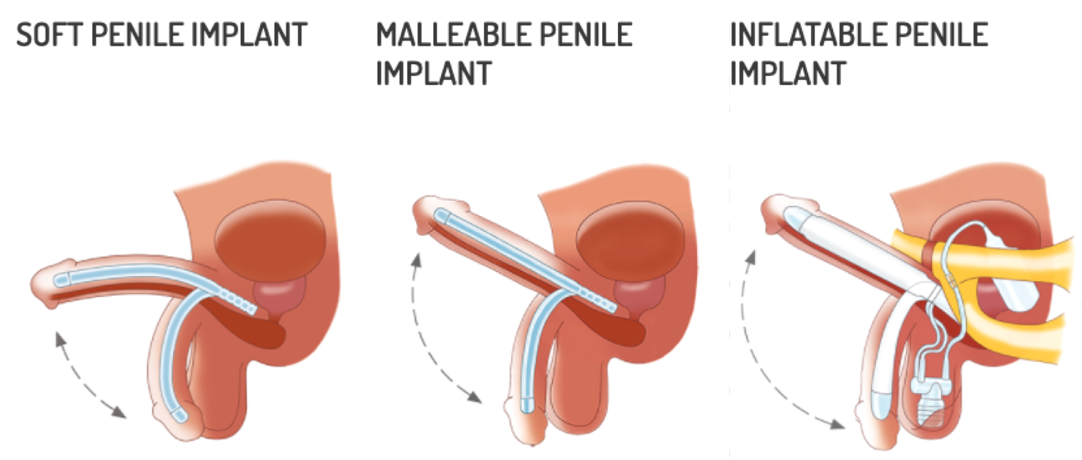 penile implant types