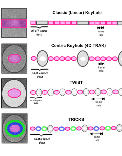 bolus chase MRA; TRICKS; TWIST