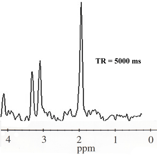 MR spectroscopy