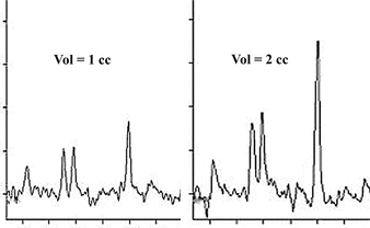 MR spectroscopy voxel size